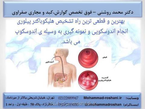 انجام آندوسكوپی و كولونوسكوپی